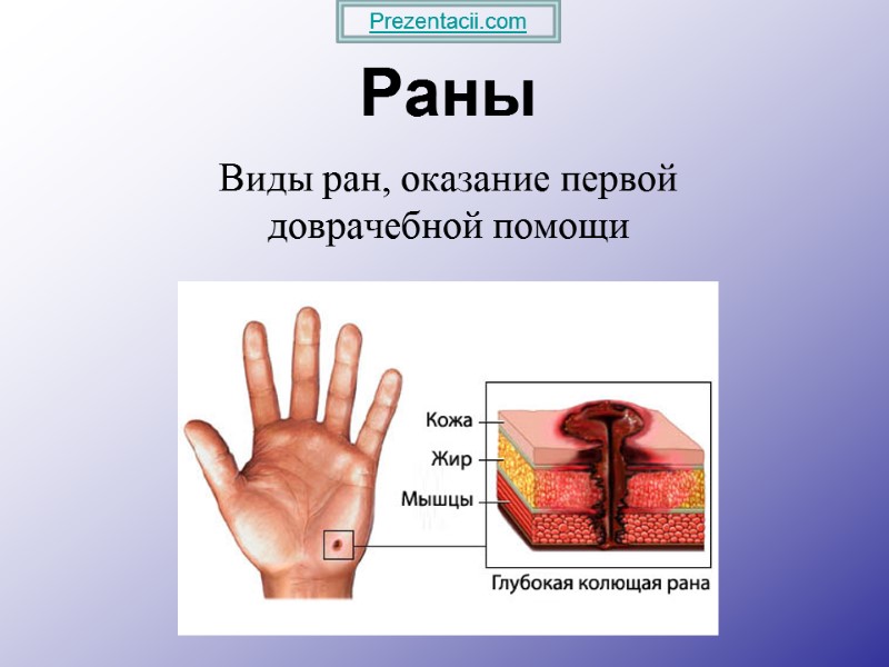 Раны Виды ран, оказание первой доврачебной помощи Prezentacii.com